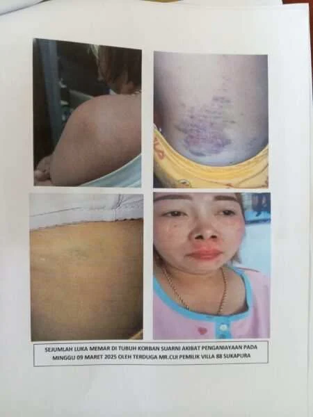Dugaan Penganiayaan di Sukapura: Korban Sudah Visum, Kasus Masih ‘Dibekukan’
