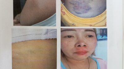 Dugaan Penganiayaan di Sukapura: Korban Sudah Visum, Kasus Masih ‘Dibekukan’